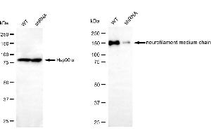 Western blotting analysis using neurofilament medium chain antibody (ABIN7799581).