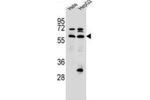Western Blotting (WB) image for anti-Selenoprotein N, 1 (SEPN1) antibody (ABIN2996755) (SEPN1 antibody)