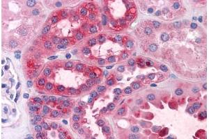 Human Kidney: Formalin-Fixed, Paraffin-Embedded (FFPE) (GPN1 antibody  (AA 9-119))