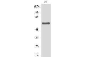 Western Blotting (WB) image for anti-Inter-alpha Globulin Inhibitor H2 Polypeptide (ITIH2) (Asp702), (cleaved) antibody (ABIN3180420) (ITIH2 antibody  (Asp702, cleaved))
