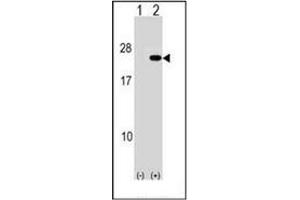 Western blot analysis of PAIP2 (arrow) using PAIP2 Antibody (N-term) Cat. (PAIP2 antibody  (N-Term))