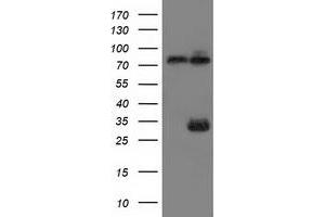HEK293T cells were transfected with the pCMV6-ENTRY control (Left lane) or pCMV6-ENTRY MYD88 (Right lane) cDNA for 48 hrs and lysed. (MYD88 antibody)