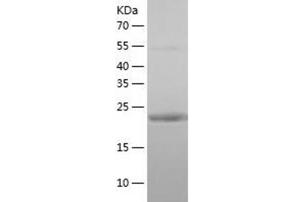 TNRC5 Protein (AA 31-278) (His tag)