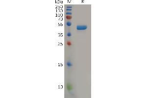 SDS-PAGE (SDS) image for Interleukin 2 (IL2) (AA 21-153) protein (mFc Tag) (ABIN7092734)