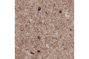 Immunohistochemical staining (Formalin-fixed paraffin-embedded sections) of human cerebral cortex with GAD1 monoclonal antibody, clone CL2911  shows immunoreactivity in neuropil, as well as some neuronal cells bodies. (GAD antibody)