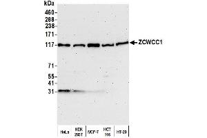 anti-MORC Family CW-Type Zinc Finger 2 (MORC2) (AA 600-700) antibody