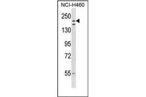 Western blot analysis of RNF160 Antibody  in NCI-H460 cell line lysates (35ug/lane). (RNF160 antibody  (Middle Region))