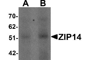 Western Blotting (WB) image for anti-Solute Carrier Family 39 (Zinc Transporter), Member 14 (SLC39A14) (Middle Region) antibody (ABIN1031178) (SLC39A14 antibody  (Middle Region))