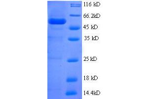 SDS-PAGE (SDS) image for BMI1 Polycomb Ring Finger Oncogene (BMI1) (AA 1-250), (partial) protein (GST tag) (ABIN7479609)