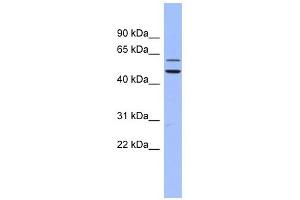 DKC1 antibody used at 1 ug/ml to detect target protein. (DKC1 antibody  (N-Term))