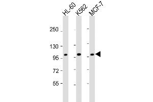 Western Blot at 1:2000 dilution Lane 1: HL-60 whole cell lysate Lane 2: K562 whole cell lysate Lane 3: MCF-7 whole cell lysate Lysates/proteins at 20 ug per lane. (GEN1 antibody  (N-Term))