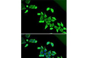 Immunofluorescence analysis of U2OS cells using CDKAL1 Polyclonal Antibody (CDKAL1 antibody)