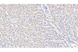 Detection of AT in Bovine Liver Tissue using Polyclonal Antibody to Antithrombin (AT) (SERPINC1 antibody  (AA 33-465))