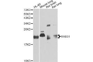 Western blot analysis of extracts of various cell lines, using RAB31 antibody (ABIN5995563) at 1/1000 dilution. (RAB31 antibody)