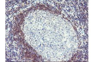Immunohistochemical staining of paraffin-embedded Human tonsil using anti-PLDN mouse monoclonal antibody.