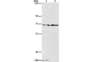 Western blot analysis of HepG2 and 293T cell, using IFT74 Polyclonal Antibody at dilution of 1:1400 (IFT74 antibody)