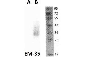 Western blotting analysis of FOLR2 in THP1 cells (A) and FOLR2-transfected THP1 cells (B) using anti-FOLR2 (EM-35) purified.