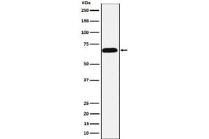 Western Blotting (WB) image for anti-Alkaline Phosphatase (ALP) antibody (ABIN7606782)