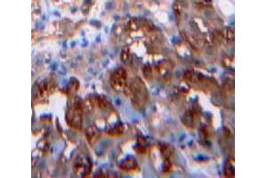 IHC-P analysis of Kidney tissue, with DAB staining. (Leptin antibody  (AA 22-167))