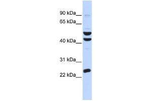 WB Suggested Anti-ZNF200 Antibody Titration:  0. (ZNF200 antibody  (Middle Region))