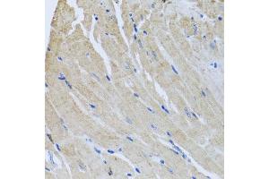 Immunohistochemistry of paraffin-embedded mouse heart using SRI antibody  at dilution of 1:100 (40x lens). (SRI antibody  (AA 1-198))