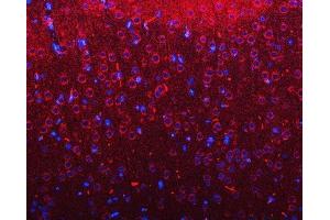 IF analysis of RIMBP2 using anti-RIMBP2 antibody (ABIN7601441). (RIMBP2 antibody  (AA 351-1049))