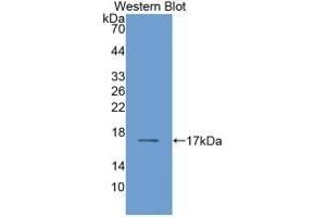 Detection of Recombinant RBP2, Human using Monoclonal Antibody to Retinol Binding Protein 2, Cellular (RBP2) (RBP2 antibody  (AA 1-134))