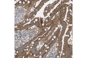 Immunohistochemical staining of human duodenum with GCC2 polyclonal antibody  shows moderate cytoplasmic and membranous positivity in glandular cells at 1:200-1:500 dilution. (GCC2 antibody)