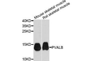 Western blot analysis of extracts of mouse skeletal muscle cells, using PVALB antibody. (PVALB antibody)