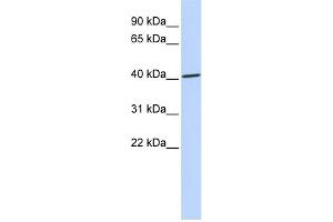 WB Suggested Anti-ZNF696 Antibody Titration:  0.