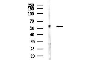 anti-Homocysteine-Inducible, Endoplasmic Reticulum Stress-Inducible, Ubiquitin-Like Domain Member 1 (HERPUD1) (N-Term) antibody