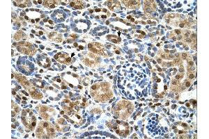 Immunohistochemistry (IHC) image for anti-Zinc Finger Protein 169 (ZNF169) (Middle Region) antibody (ABIN2783123) (ZNF169 antibody  (Middle Region))