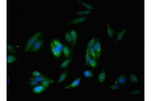Immunofluorescent analysis of Hela cells using ABIN7171205 at dilution of 1:100 and Alexa Fluor 488-congugated AffiniPure Goat Anti-Rabbit IgG(H+L) (SYNM antibody  (AA 1147-1417))