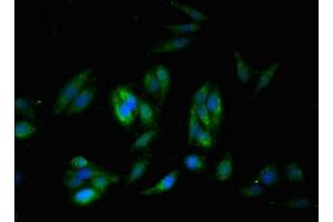 Immunofluorescent analysis of Hela cells using ABIN7171205 at dilution of 1:100 and Alexa Fluor 488-congugated AffiniPure Goat Anti-Rabbit IgG(H+L)