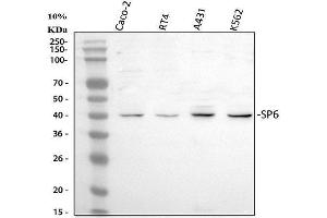 Western blot analysis of SP6 using anti-SP6 antibody (ABIN5692945). (SP6 antibody)