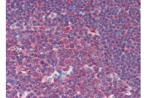 Human Tonsil: Formalin-Fixed, Paraffin-Embedded (FFPE) (CUEDC2 antibody  (C-Term))