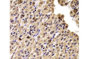 Immunohistochemistry of paraffin-embedded Rat stomach using CCT4 Polyclonal Antibody at dilution of 1:100 (40x lens). (CCT4 antibody)