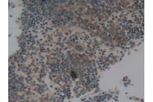 IHC-P analysis of Mouse Spleen Tissue, with DAB staining. (NCF4 antibody  (AA 111-339))