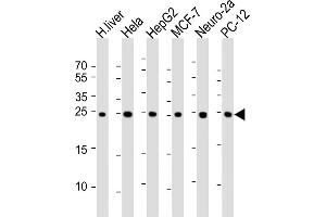 All lanes : Anti-PS Antibody at 1:1000 dilution Lane 1: human liver lysate Lane 2: Hela whole cell lysate Lane 3: HepG2 whole cell lysate Lane 4: MCF-7 whole cell lysate Lane 5: Neuro-2a whole cell lysate Lane 6: PC-12 whole cell lysate Lysates/proteins at 20 μg per lane.
