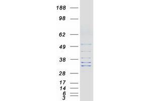 Western Blotting (WB) image for Regulator of Microtubule Dynamics 1 (RMDN1) protein (Myc-DYKDDDDK Tag) (ABIN2720810)
