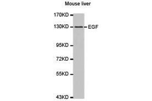 Western Blotting (WB) image for anti-Epidermal Growth Factor (EGF) antibody (ABIN1872450) (EGF antibody)