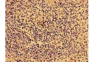 Immunohistochemistry of paraffin-embedded human spleen tissue using ABIN7149294 at dilution of 1:100 (IL2RG antibody  (AA 75-230))