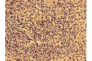 Immunohistochemistry of paraffin-embedded human spleen tissue using ABIN7149294 at dilution of 1:100 (IL2RG antibody  (AA 75-230))