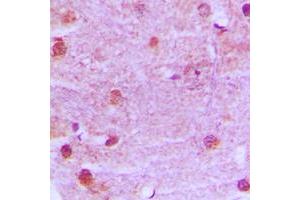 Immunohistochemical analysis of MRE11 staining in human brain formalin fixed paraffin embedded tissue section. (Mre11 antibody  (Center))