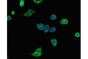 Immunofluorescent analysis of HepG2 cells using ABIN7144789 at dilution of 1:100 and Alexa Fluor 488-congugated AffiniPure Goat Anti-Rabbit IgG(H+L) (Ataxin 2 antibody  (AA 174-383))