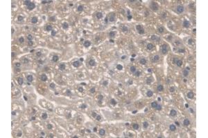 Detection of SPTLC1 in Mouse Liver Tissue using Polyclonal Antibody to Serine Palmitoyltransferase, Long Chain Base Subunit 1 (SPTLC1) (SPTLC1 antibody  (AA 143-473))