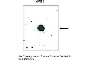 DB Suggested Anti-Nme1 antibody  Titration: 0. (NME1 antibody  (C-Term))