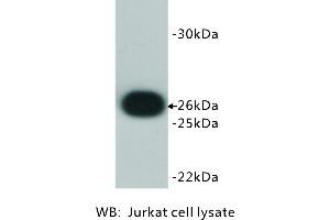 Image no. 3 for anti-B-Cell CLL/lymphoma 2 (BCL2) antibody (ABIN1112797) (Bcl-2 antibody)