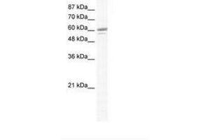 Image no. 1 for anti-Zinc Finger Protein 232 (ZNF232) (AA 204-253) antibody (ABIN6736012) (ZNF232 antibody  (AA 204-253))