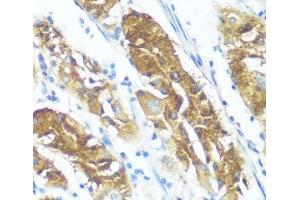 Immunohistochemistry of paraffin-embedded Human stomach using NME3 Polyclonal Antibody at dilution of 1:100 (40x lens). (NME3 antibody)